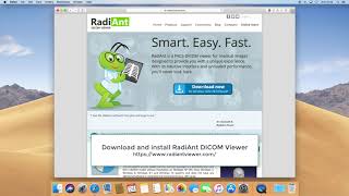 Windows dicom viewer free download